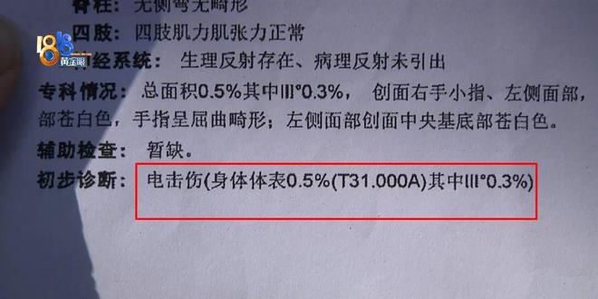 PP电子后怕！5岁男童瞬间晕厥筋都断了……街上常见看见立即远离(图3)